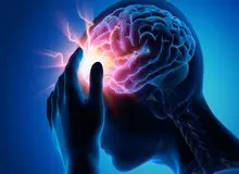 یک متخصص مغز و اعصاب: جوانان ایرانی ۷ برابر میانگین جهانی در معرض سکته مغزی‌اند
