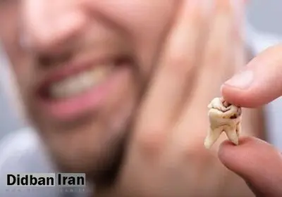 کسی‌که به‌دلیل مشکلات اقتصادی گوشت و شیر نمی‌خورد قطعا سلامت دندان در اولویتش نیست/ کاهش کیفیت آموزش پزشکی؛ با رتبه چهل هزار و سهمیه دکتر می‌شوند!