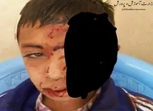 سقوط دانش آموز از کوه به خاطر شبکه شاد/ آموزش و پرورش: برای چیدن گل زعفران رفته بود!