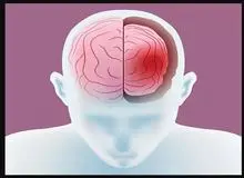 کمبود این ویتامین مغز را کوچک می‌کند