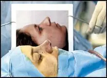 زن45ساله،زیر عمل جراحی زیبایی جان داد