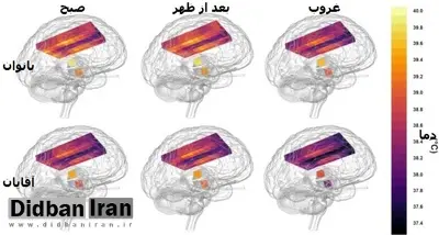 مغز زنان داغ تر از مردان است!/ یک کشف جالب در نقشه۴ بعدی دمای مغز(+عکس)