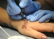 اپیدمی پاک کردن تتو