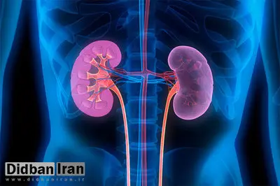 این عادتهای غلط سنگ کلیه میسازند