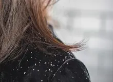 شوره‌ی سر را به کمک آسپرین در منزل درمان کنید!