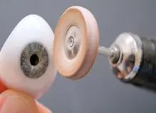 مرکز ساخت چشم مصنوعی در تهران