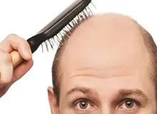 با مهم ترین عواملی که باعث ریزش مو می شوند آشنا شوید