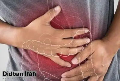 شیوع بیماری گوارشی جدید در کشور/ راههای انتقال و علائم بیماری