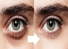 ۷ عادت اشتباه که عامل سیاهی و گودی زیر چشم می‌باشد