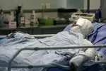 اعلام آمار سالانه سوختگی در ایران/ چند نفر از مصدومان فوت می‌شوند؟