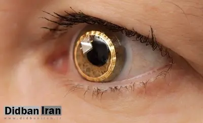 یک ایمپلنت چشمی به نزدیک به ۳۰ فرد نابینا کمک کرد تا دوباره بینایی خود را بازیابند