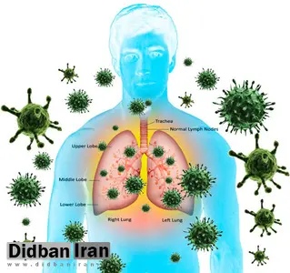 با راه های پیشگیری از بیماری کرونا آشنا شوید