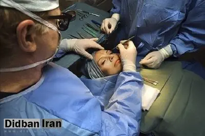 ممنوعیت عمل جراحی زیبایی توسط پزشکان عمومی برداشته شد
