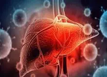 چرا به کبد چرب مبتلا می‌شویم؟/ ۱۰ راهکار برای دور ماندن از کبد چرب