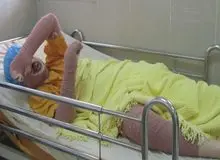 روایت‌هایی از قصه دخترانی که خودسوزی می‌کنند/ دخترانی که درون‌شان می‌سوزد تا تمام شوند