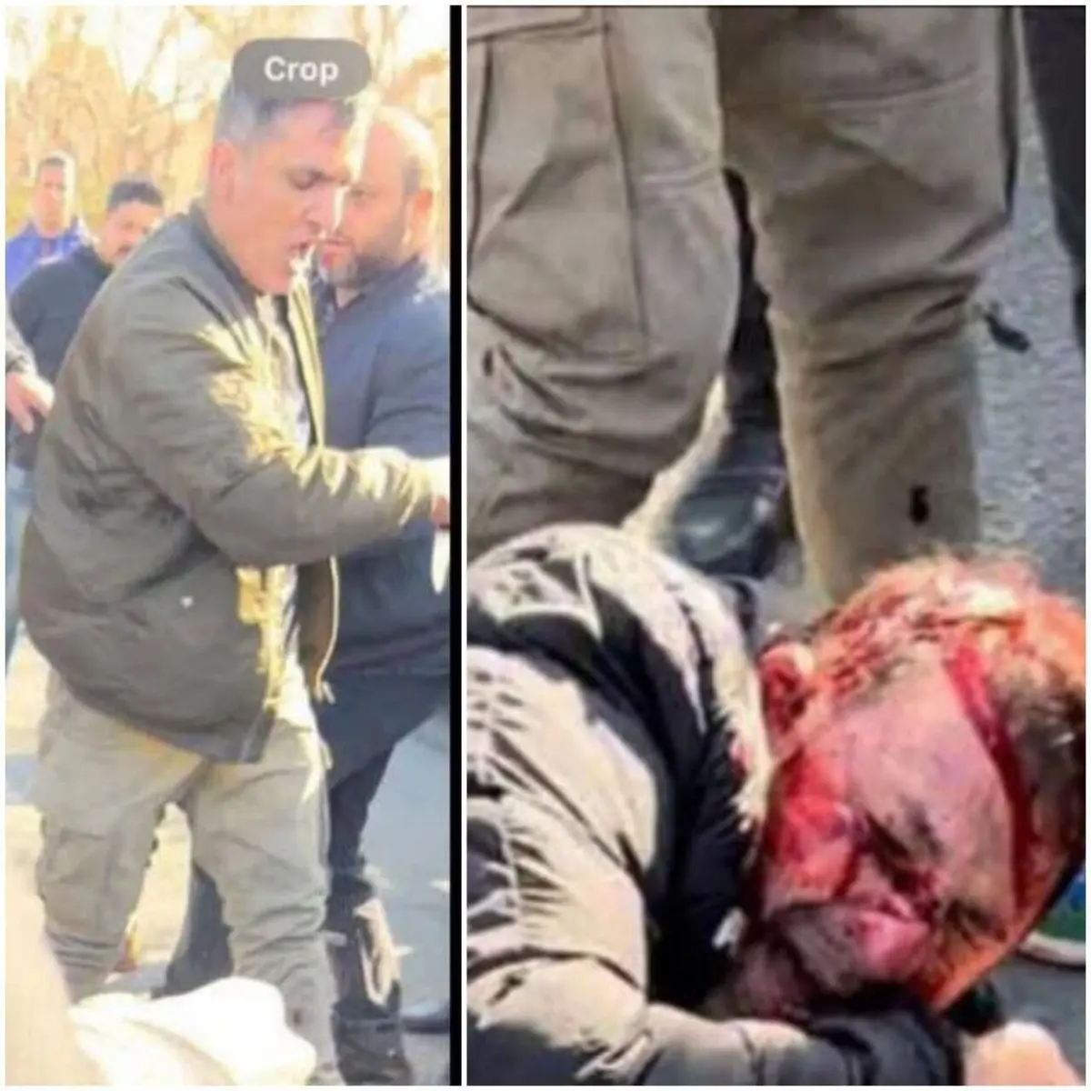 اولین تصویر از صورت خونین هانی کرده/عکس فرد تیرانداز و لحظه تیراندازی