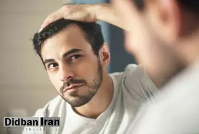 راهکارهای طب ایرانی برای تقویت مو
