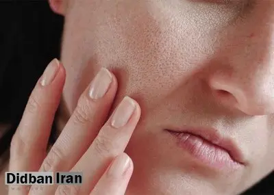 ۵ ماده غذایی مفید برای سلامت پوست
