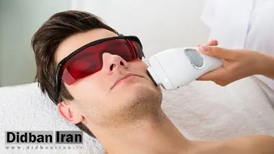بهترین دستگاه لیزر مو های زائد کدام است؟