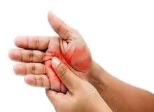 گز گز کردن دست نشانه چیست؟