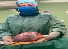 خارج کردن توده ۵ کیلویی از شکم زن اسدآبادی+تصویر