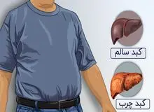 کبد چرب را با این روش به‌راحتی درمان کنید