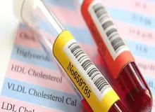 با نشانه های کمبود آهن در بدن آشنا شوید