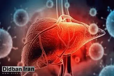 علامت مهم و زنگ خطر بیماریهای کبد