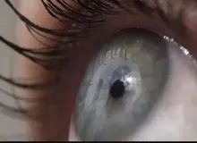 دانشمندان سوئدی برای درمان دیابت ایمپلنت‌های چشمی تولید کردند