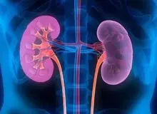 مشروبات الکلی سنگ کلیه را درمان می‌کند؟
