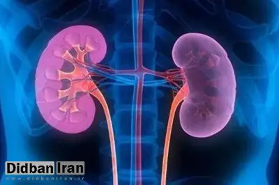 مشروبات الکلی سنگ کلیه را درمان میکند؟
