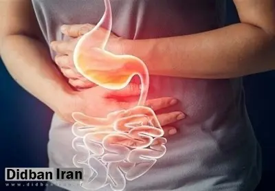 طغیان بیماریهای گوارشی در برخی نقاط کشور/ وزارت بهداشت: وضعیت تحت کنترل است