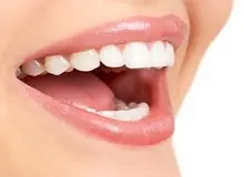 عوارض درمان‌های زیبایی دندانپزشکی به روش انجام آن‌ها بستگی دارد
