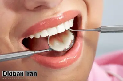 بیماریهای لثه باعث مرگ زودهنگام زنان میشود