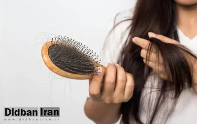 سه روغن طبیعی برای تسریع رشد مو