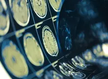 یک تراشه کامپیوتری می‌تواند ذهن افراد را با دقت ۷۴ درصد بخواند