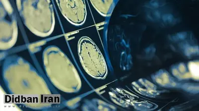 یک تراشه کامپیوتری می‌تواند ذهن افراد را با دقت ۷۴ درصد بخواند