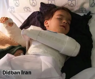 عذر خواهی پزشک و جوابیه علوم پزشکی اصفهان/ دست چپ کودک 2 ساله به جای راست جراحی شد