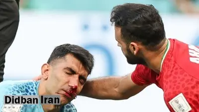 بیرانوند جام جهانی را از دست داد