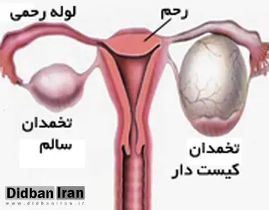  درباره یک نگرانی شایع زنانه‌ چقدر می‌دانید؟