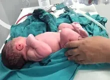 مظنه سزارین‌های میلیونی/ سهم هزینه بهداشت و درمان از سبد هزینه ای خانوارهای شهری 6 درصد است