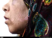 شوهر اعظم به ۱۵ سال حبس محکوم شد/ شش ماه! حبس تعزیری بابت کودک‌آزاری/ اعظم زن مشهدی که ۲۱ روز تحت شکنجه شوهرش بود
