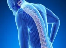 ۱۲ توصیه مهم برای پیشگیری از پوکی استخوان