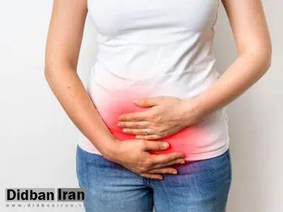 ۵ عامل عفونت قارچی در ناحیه تناسلی زنان
