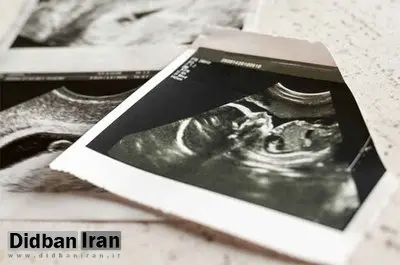 ۴۰درصد از زنان ایران به دلیل عدم توانایی مالی و فقر سقط جنین می کنند