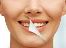 با این ۶ روش دندان‌هایتان مثل برف می‌درخشد