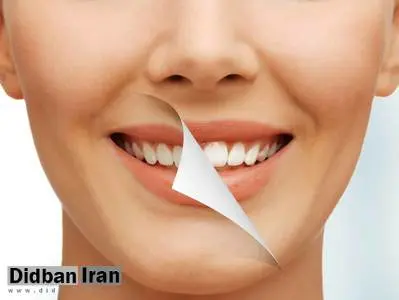 با این ۶ روش دندان‌هایتان مثل برف می‌درخشد