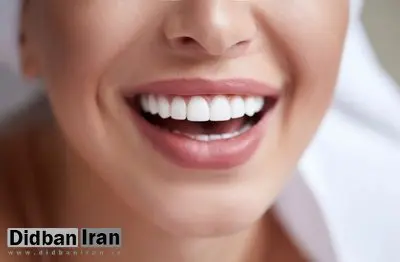 ۶ روش خانگی و ساده برای سفید شدن دندان‌ها 