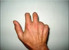 اجرای حکم قطع انگشتان دست دو سارق در قم