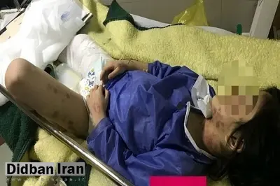 جزئیات تکان دهنده جدید از حادثه کودک آزاری در مهاباد/ والدین معتاد؛ متهمان اصلی/ شکنجه 2 ماهه دلیل وحشت کودک از اطرافیان+ عکس